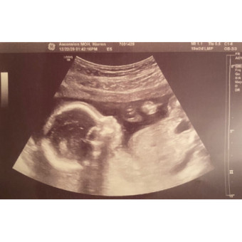 Babylist Registry Photo.