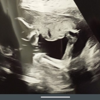 Babylist Registry Photo.