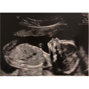 Babylist Registry Photo.
