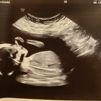 Babylist Registry Photo.