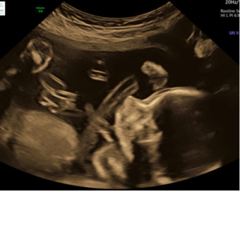 Babylist Registry Photo.