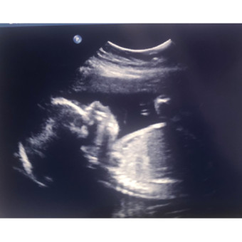 Babylist Registry Photo.