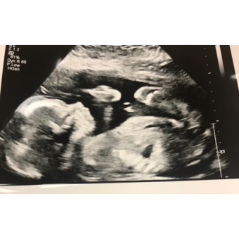 Babylist Registry Photo.