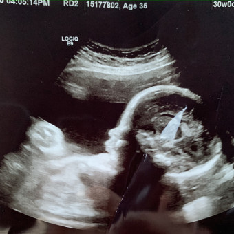 Babylist Registry Photo.