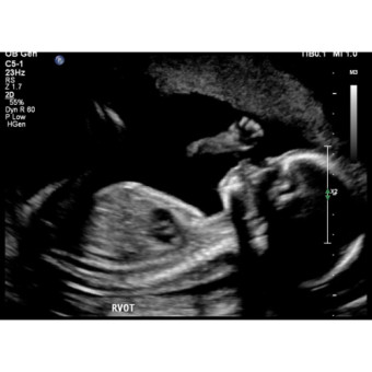 Babylist Registry Photo.
