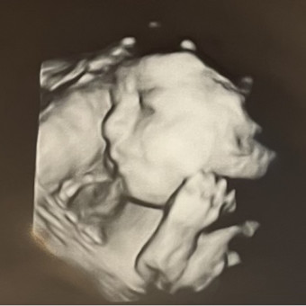 Babylist Registry Photo.