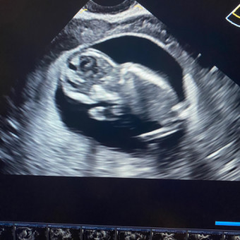 Babylist Registry Photo.