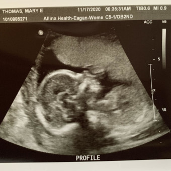 Babylist Registry Photo.
