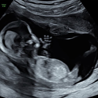 Babylist Registry Photo.