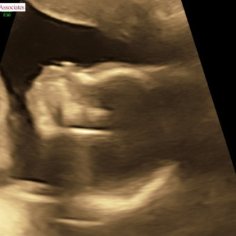 Babylist Registry Photo.