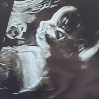 Babylist Registry Photo.