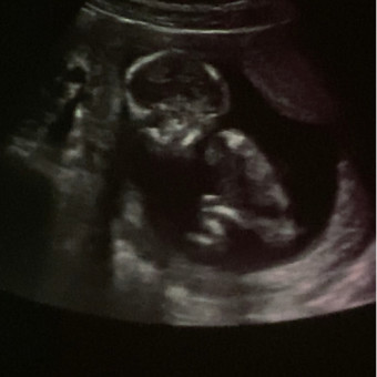 Babylist Registry Photo.