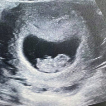 Babylist Registry Photo.