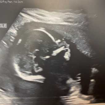 Babylist Registry Photo.