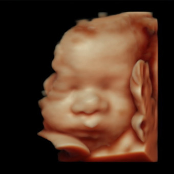 Babylist Registry Photo.