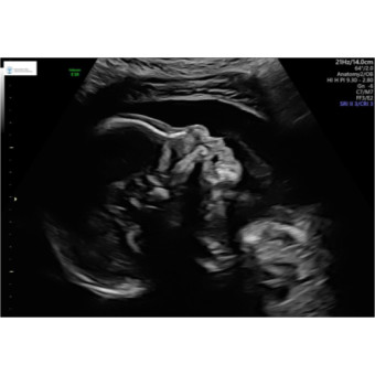Babylist Registry Photo.