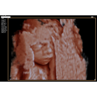 Babylist Registry Photo.