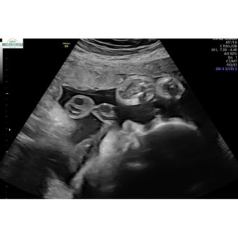Babylist Registry Photo.
