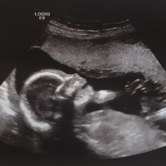 Babylist Registry Photo.