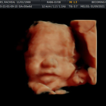 Babylist Registry Photo.