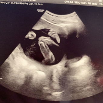 Babylist Registry Photo.