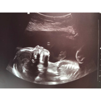 Babylist Registry Photo.