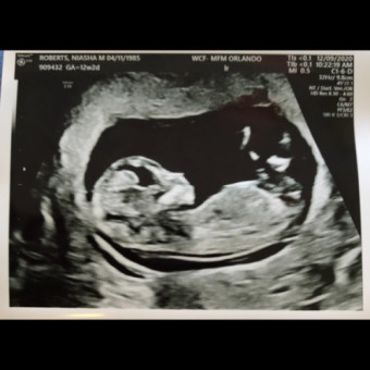 Babylist Registry Photo.