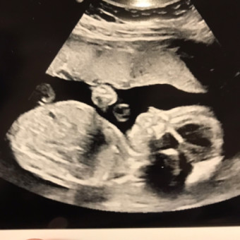 Babylist Registry Photo.