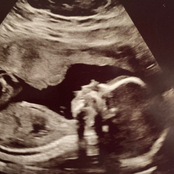 Babylist Registry Photo.