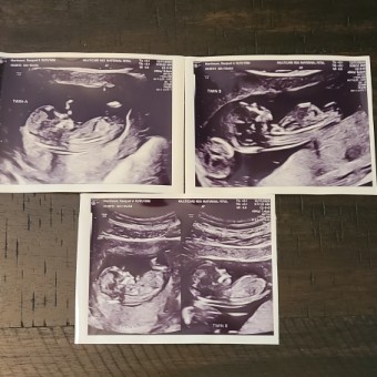 Babylist Registry Photo.
