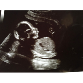 Babylist Registry Photo.