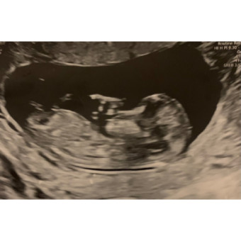 Babylist Registry Photo.