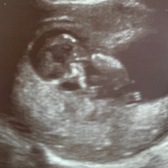 Babylist Registry Photo.
