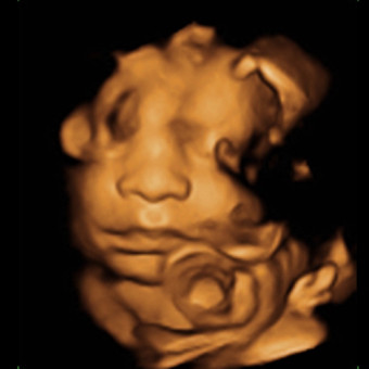 Babylist Registry Photo.