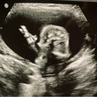 Babylist Registry Photo.