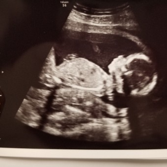 Babylist Registry Photo.