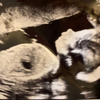 Babylist Registry Photo.