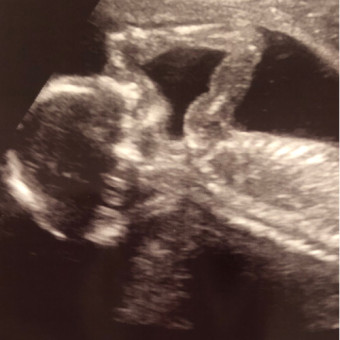 Babylist Registry Photo.