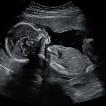 Babylist Registry Photo.