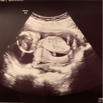 Babylist Registry Photo.