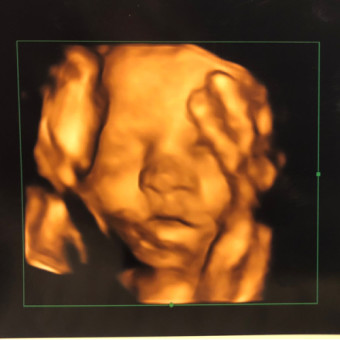 Babylist Registry Photo.