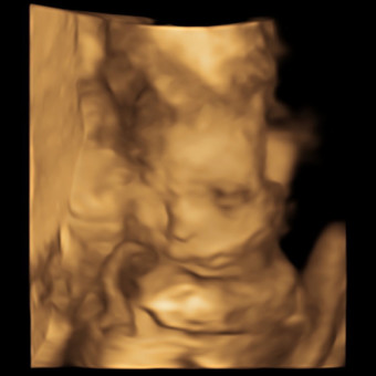 Babylist Registry Photo.