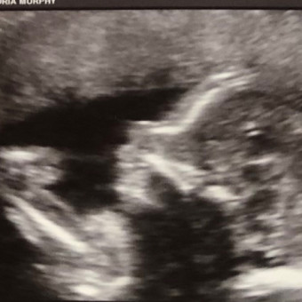 Babylist Registry Photo.