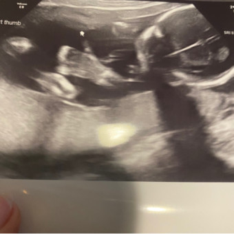 Babylist Registry Photo.