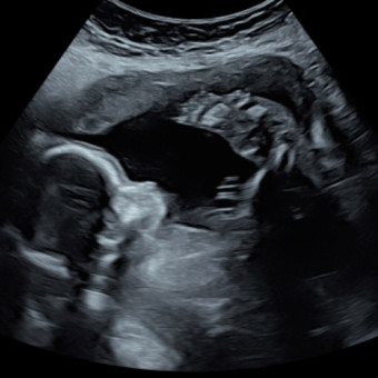 Babylist Registry Photo.