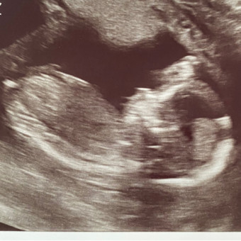 Babylist Registry Photo.
