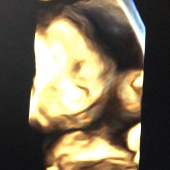 Babylist Registry Photo.