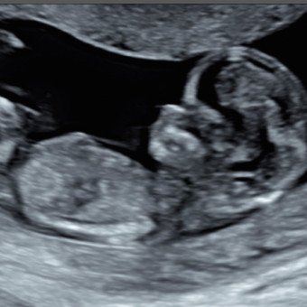 Babylist Registry Photo.