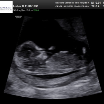 Babylist Registry Photo.