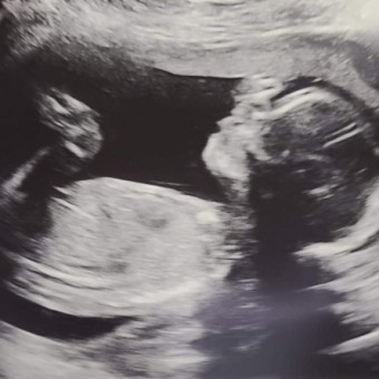 Babylist Registry Photo.
